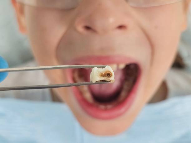 Best Urgent Tooth Repair  in Jamesport, NY