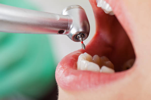 Best Chipped Tooth Repair Near Me  in Jamesport, NY